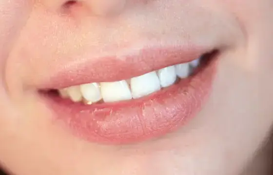 4. COMO ESCREVEMOS BOCA EM INGLÊS?