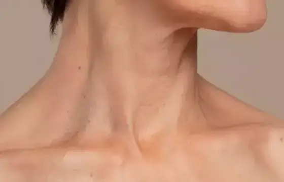 3. COMO ESCREVEMOS PESCOÇO EM INGLÊS?