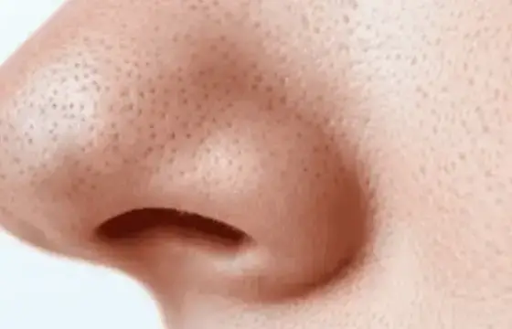 5. COMO ESCREVEMOS NARIZ EM INGLÊS?