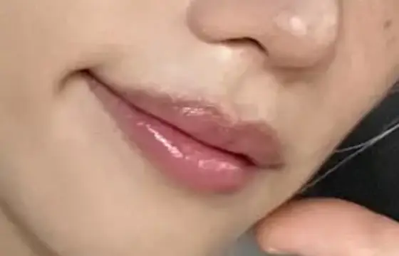 De qual boca é esse membro?