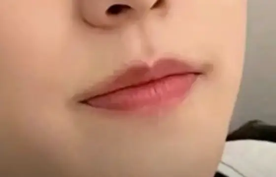 De qual membro é essa boca?