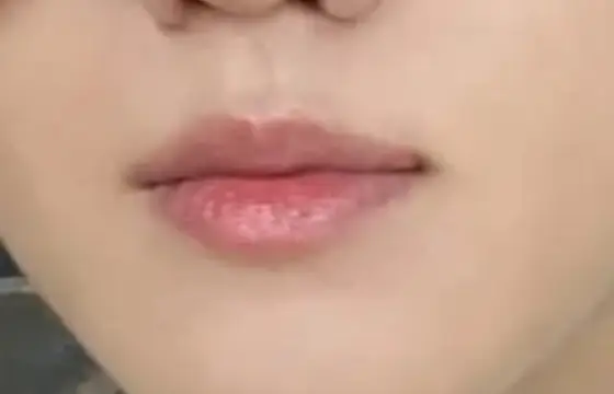 De qual membro é essa boca?