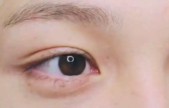 De quem é esse olho?