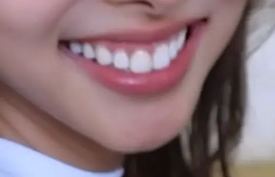 De qm eh esse sorriso armys?